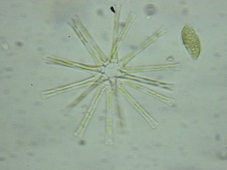 ホシガタケイソウ